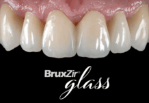 Glidewell Launches BruxZir(R) Glass Restorations