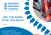 Spondylitis Association of America Launches “See the Signs. Stop the Delay.” National Awareness Campaign to Reduce Misdiagnosis and Delays in Spondyloarthritis Care