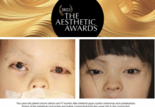 From Abandonment to Hope: Colorado Surgeon Restores Sight for Little Girl Born Without Eyelids