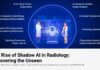 4 in 5 RSNA Radiologists Say Their Organizations Quietly Use “Shadow AI” Outside Formal Governance